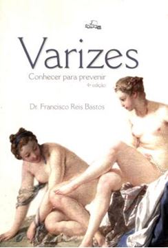 Imagem de VARIZES CONHECER PARA PREVENIR - 4ª ED