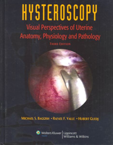 Picture of HYSTEROSCOPY - VISUAL PERSPECTIVES OF UTERINE ANATOMY, PHYSIOLOGY AND PATHOLOGY - 3RD ED