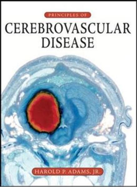 Picture of PRINCIPLES OF CEREBROVASCULAR DISEASE